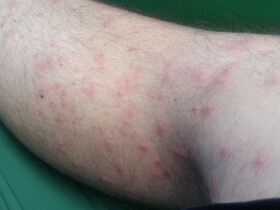 Eichen-Prozessionsspinner